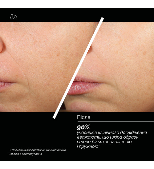 SKIN REGIMEN LX HA4 JELLY SERUM - ЗВОЛОЖУВАЛЬНИЙ КОНЦЕНТРАТ-СИРОВАТКА